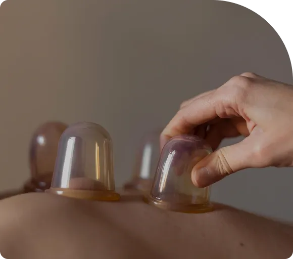 Cupping at Anura Spa, Thamel, Kathmandu